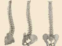 Kids' Spines More Susceptible To Accidents