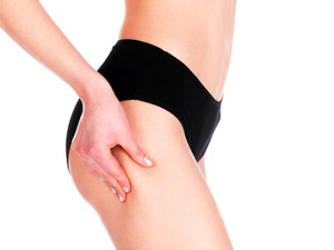 6 Effective Exercises To Treat Cellulite 6 Effective Exercises To Treat Cellulite