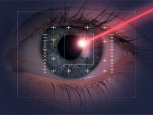 Glaucoma: Causes & Diagnosis Glaucoma: Causes & Diagnosis