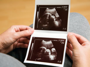Eighth Month Pregnancy: Week By Week Eighth Month Pregnancy: Week By Week