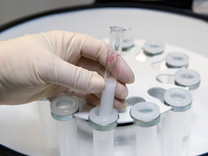 When To Go For IVF Treatment? When To Go For IVF Treatment?