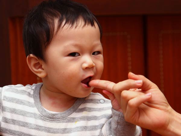 How To Stop Your Child From Biting? How To Stop Your Child From Biting?