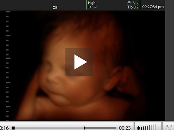 Do Babies Have Memories From The Womb? Do Babies Have Memories From The Womb?