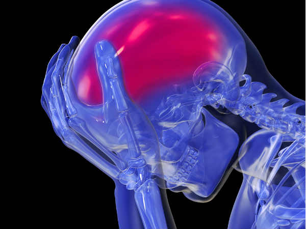 Migraine Headaches After Car Accident Migraine Headaches After Car Accident
