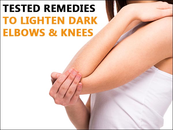 Tested Remedies To Lighten Dark Elbows &amp; Knees - Boldsky.com