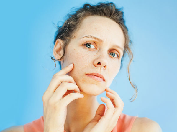 Common skin issues | How to treat skin issues | Tips to treat skin ...
