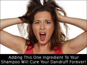 One Ingredient To Cure Dandruff Forever