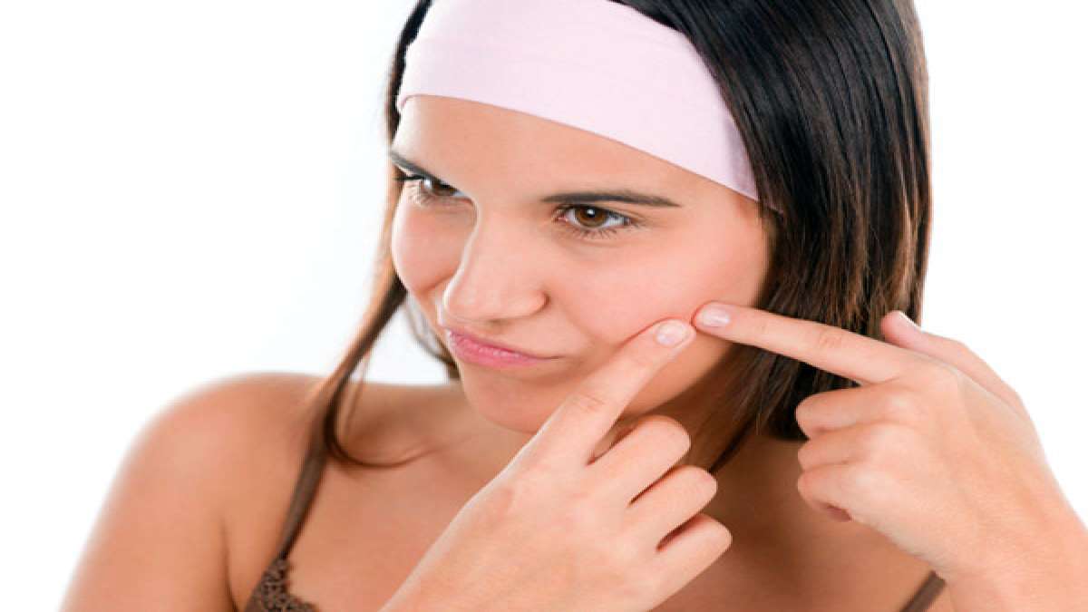 Tips To Heal Bleach Burns Quickly