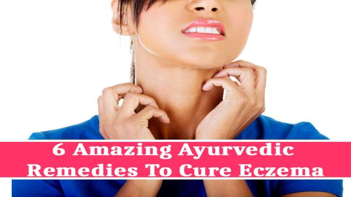 6 Amazing Ayurvedic Remedies To Cure Eczema