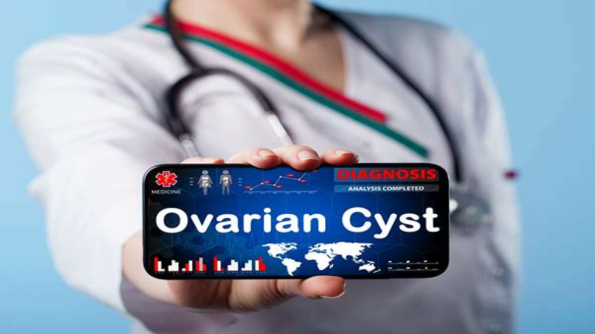 Try This Simple Home Remedy To Cure Ovarian Cysts, In A Month