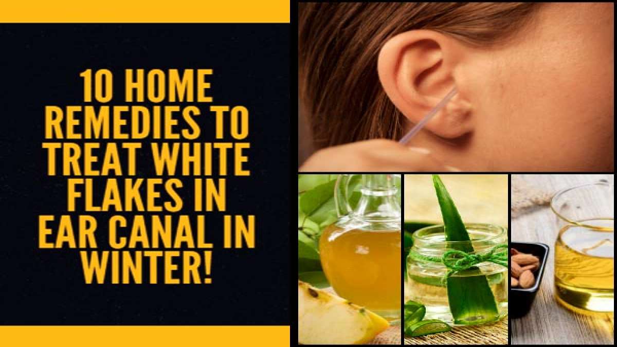 10 Home Remedies To Treat White Flakes In Ear Canal In Winter