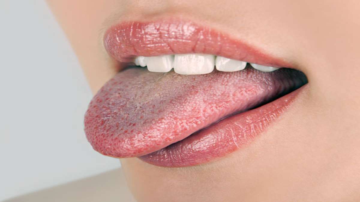 Things The Colour Of Your Tongue Is Trying To Tell You About Your Health -  Boldsky.com