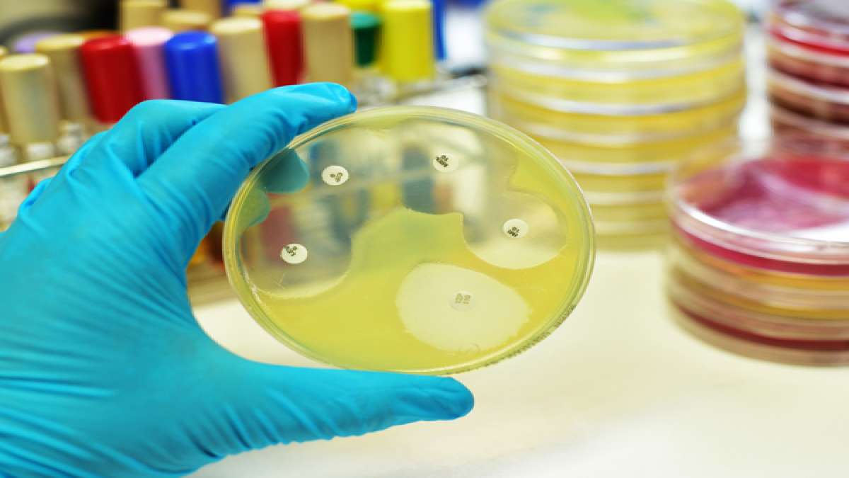 Here’s What Happens In A Urine Culture Test