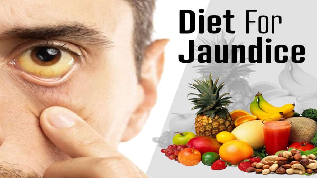 Diet For Jaundice Foods To Eat And Foods To Avoid