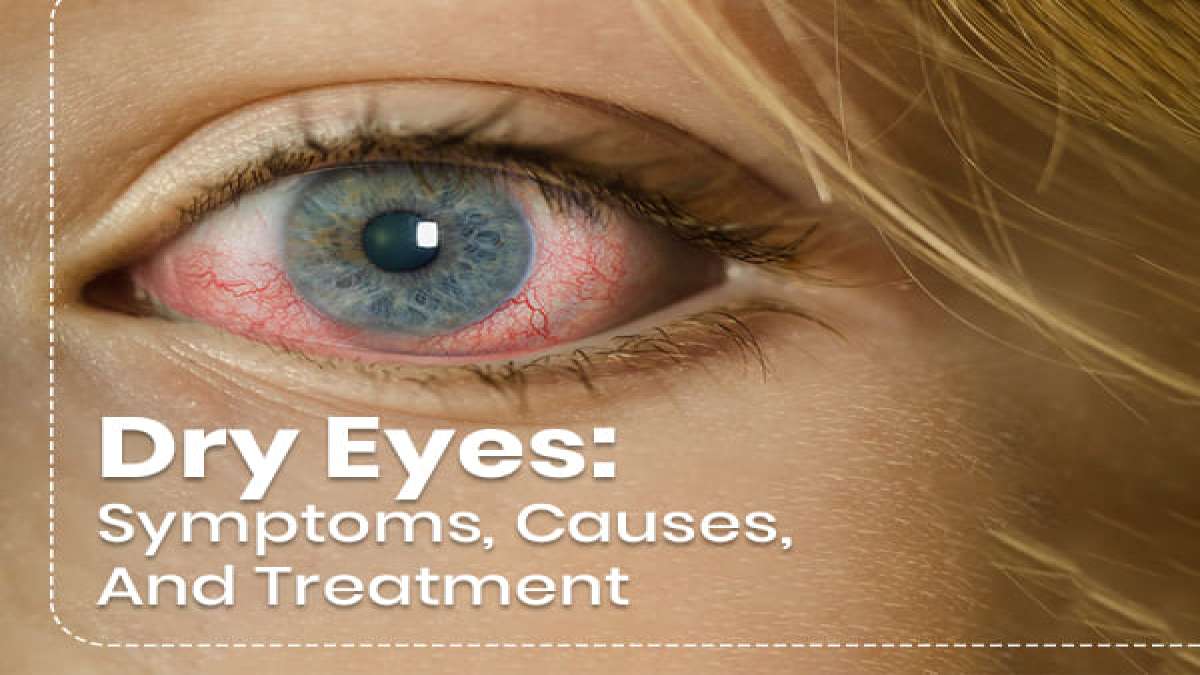 Dry Eyes Symptoms, Causes, Risk Factors,