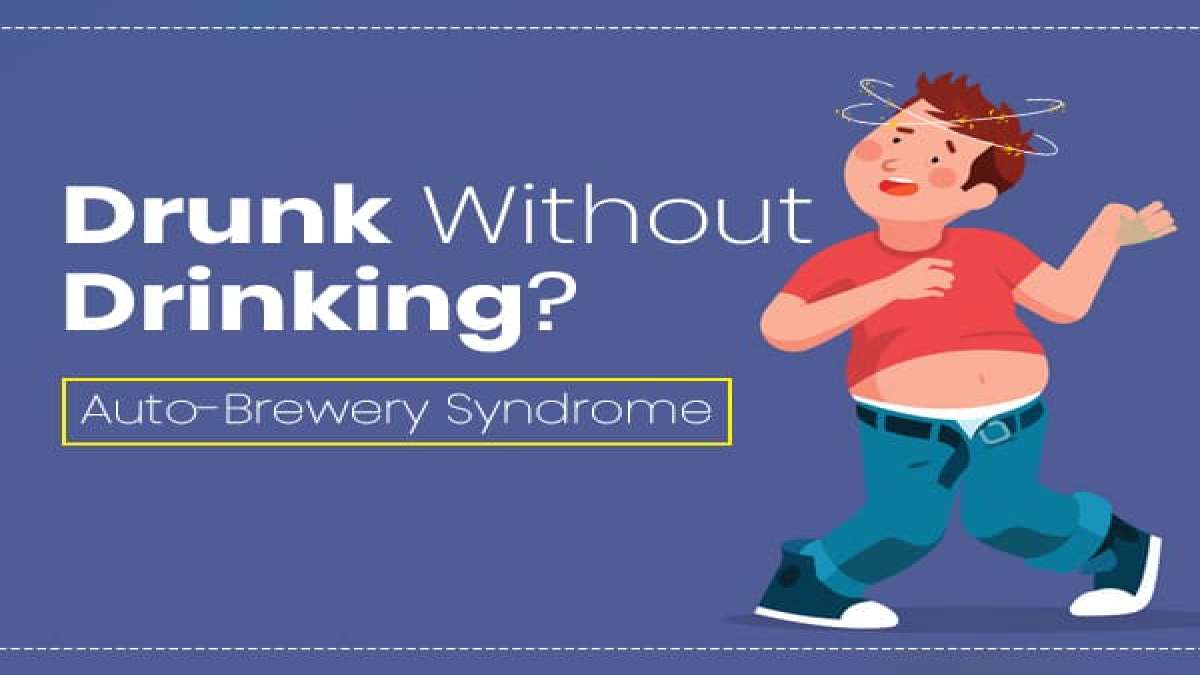 Autobrewery syndrome (ABS) Causes, Symptoms, Risk Factors, Diagnosis And Treatment