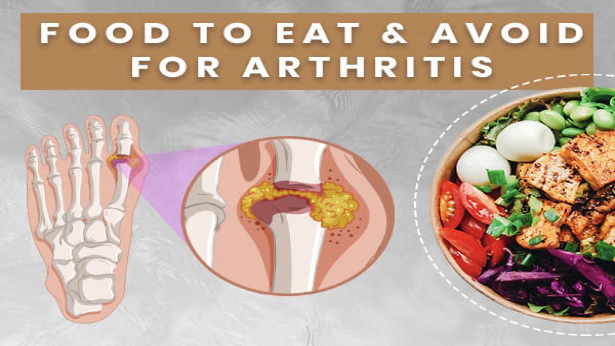 World Arthritis Day 2020 15 Foods To Eat And Avoid For Arthritis
