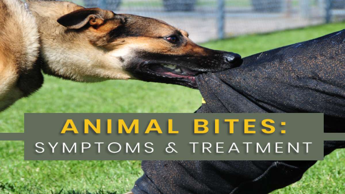 Animal Bite: Why Do They Bite? Symptoms, Complications, Diagnosis And ...