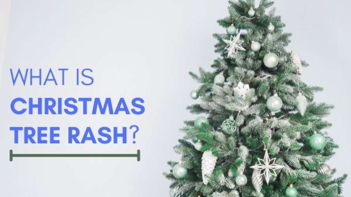 What Is Pityriasis Rosea Or Christmas Tree Rash? Causes And Symptoms