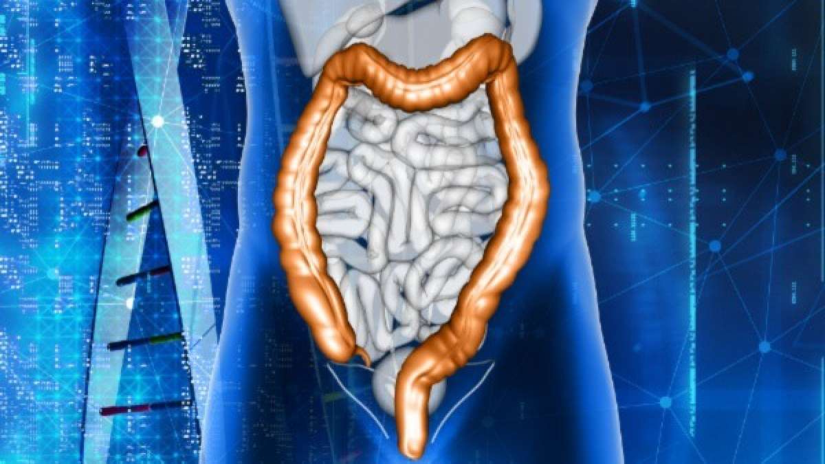 What Is Short Bowel Syndrome? Causes, Symptoms, Complications And