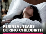 Perineal Tears During Childbirth: Know More About Degrees of Vaginal Tears And Recovery Methods