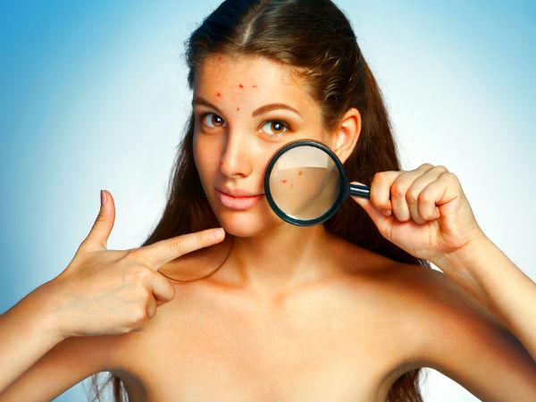 11 Dangerous Effects Of Stress On Health Boldsky