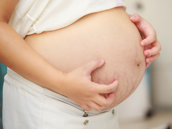 Ways To Relieve Itchy Belly In Pregnancy Boldsky Com