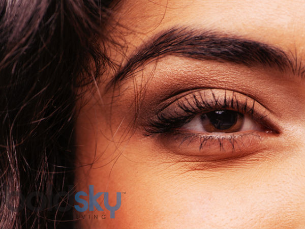 lines under eyes at 16