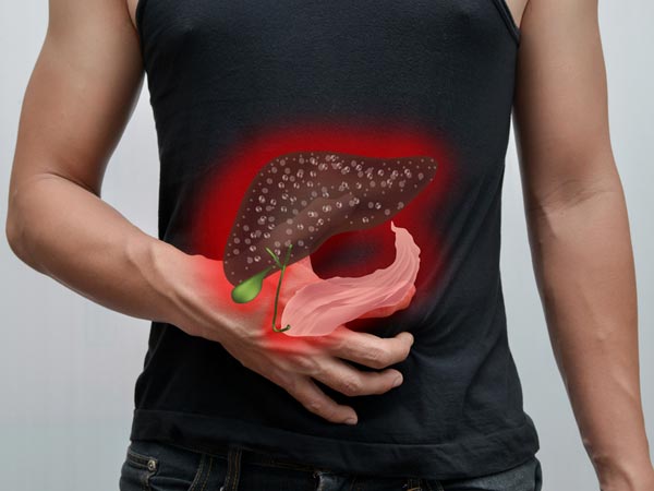 Best Ayurvedic Remedies For Fatty Liver Boldsky