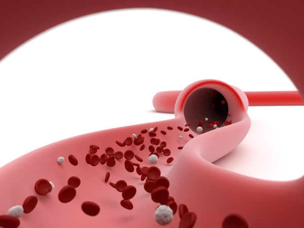 Solve Your Circulation Problems In 15 Minutes