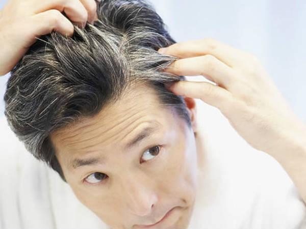 Ways To Prevent Premature Greying Boldsky Com