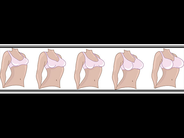 Do You Know There Are 7 Types Of Breasts?