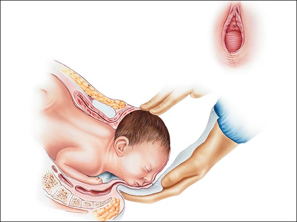 Does The Vagina Lose Its Tightness After Normal Delivery Does The Vagina Lose Its Tightness After Normal Delivery