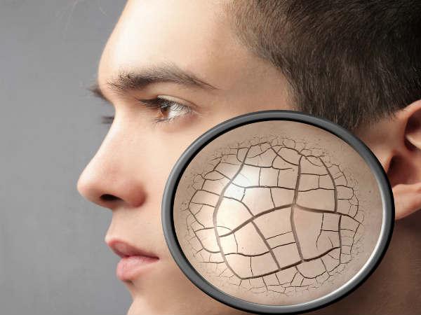 8 Surprising Signs Of Dehydration You Must Know Boldsky