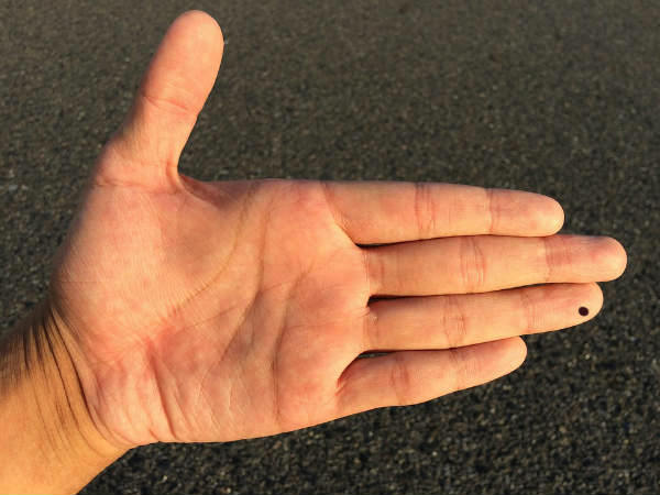 What Do Moles On Your Fingers Reveal - Boldsky.com