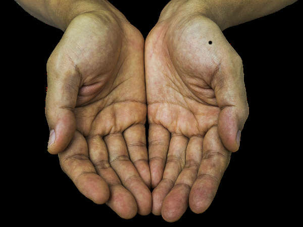 Meaning Of Moles Present On Your Palms