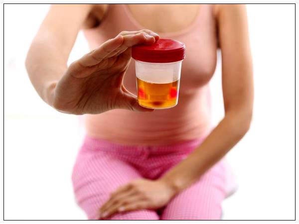 has blood in urine everything you need to about kidney failure signs symptoms causes has blood in urine everything you need to about kidney failure signs symptoms causes