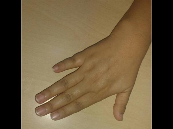 Pinky Finger Personality Test: Length of Little Finger Reveals