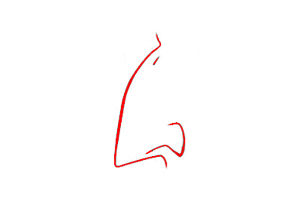 Array