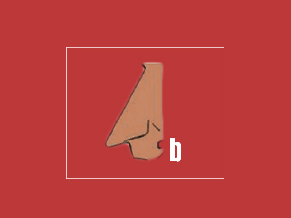 Array