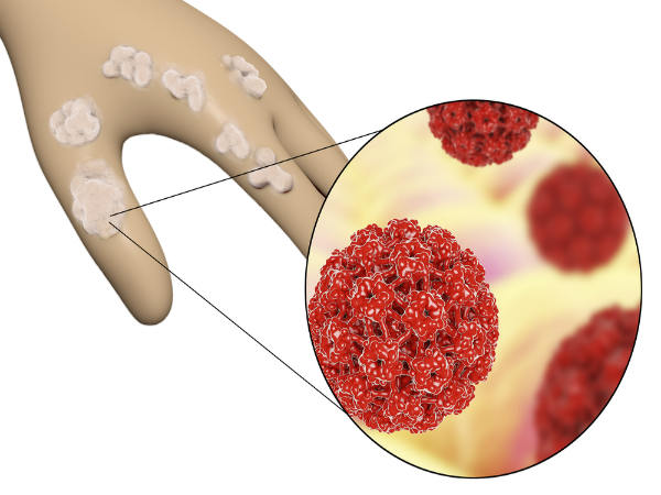 human papillomavirus while pregnant