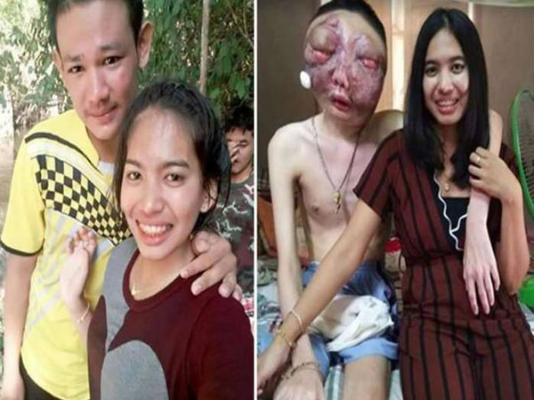 Cinta Wanita Ini Adalah Contoh Cinta Sejati, Benar-benar Luar Biasa!