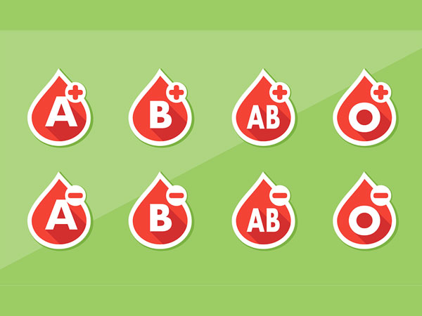 Array