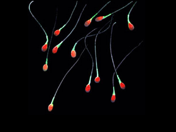 Array