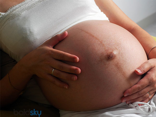 What Is Linea Nigra And When Does It Appear - Boldsky.com What Is Linea Nigra And When Does It Appear - Boldsky.com