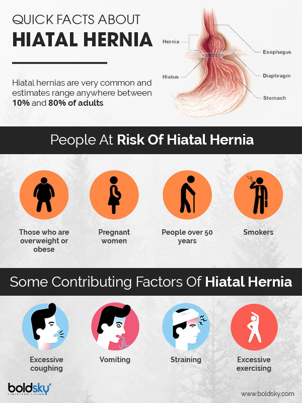 Hiatal Hernia Causes, Types, Symptoms & Treatment