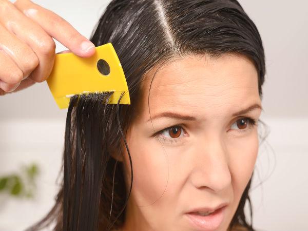21 Amazing Home Remedies To Get Rid Of Head Lice Boldsky Com