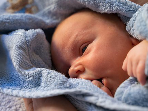 How To Deal With Cradle Cap In Babies - Boldsky.com