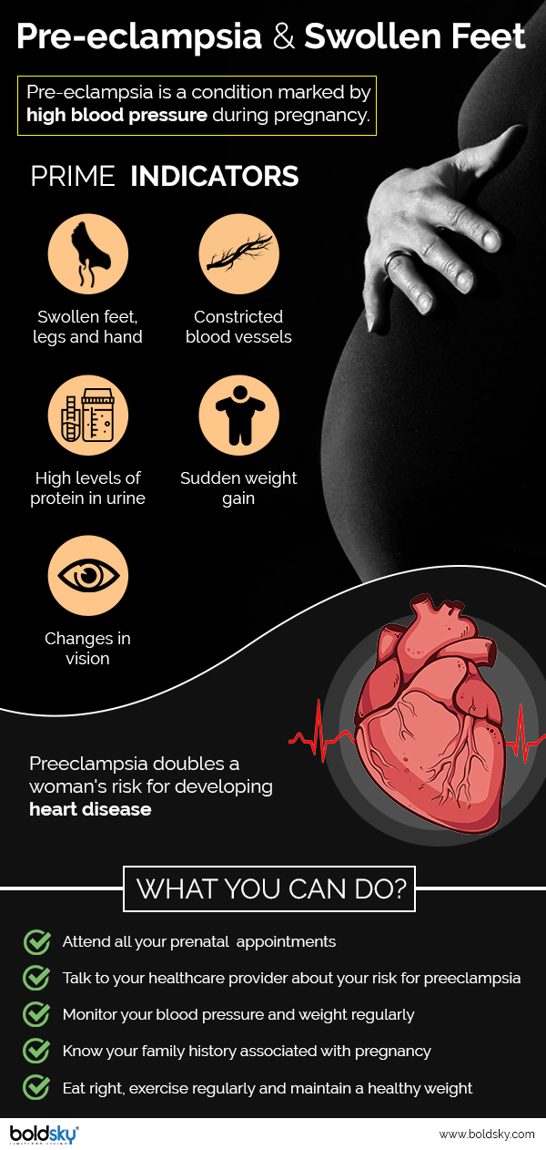14 Home Remedies For Swollen Feet During Pregnancy