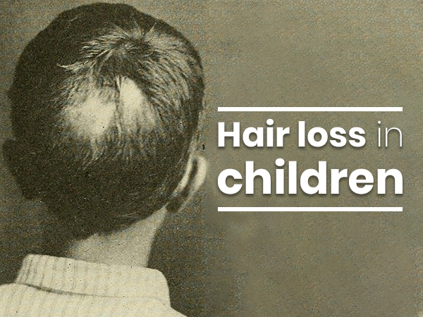 What Causes Hair Loss In Children Here S Everything You Need To Know Boldsky Com